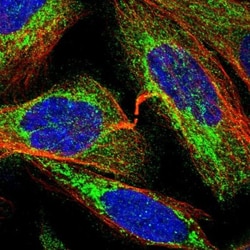 TBC1D15 Antibody, Novus Biologicals:Antibodies:Primary Antibodies